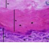 Tecido Epitelial de Revestimento Estratificado Pavimentoso Queratinizado - Pele Grossa - 100x (4)